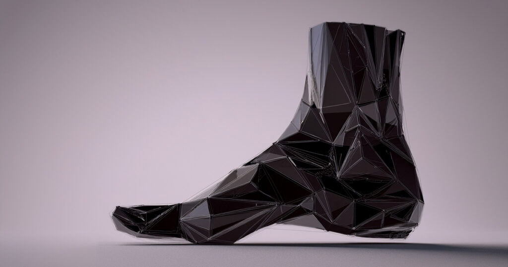 Alluce valgo - alluce valgo piede in evidenza -www.medicinaesteticabeauty.it