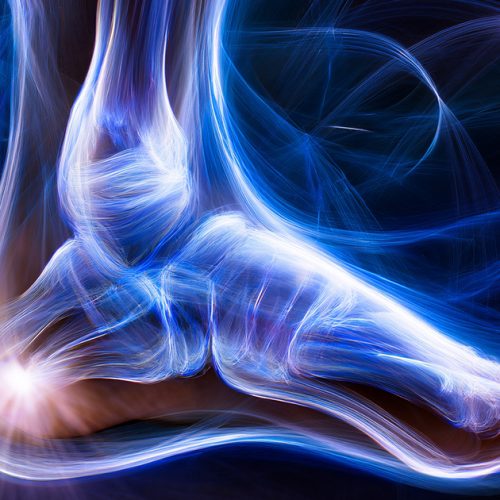 Alluce Valgo: Cos’è e Come Affrontarlo